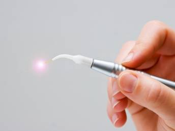 Einsatz von Dentallaser – Präzision und Komfort in der Zahnmedizin